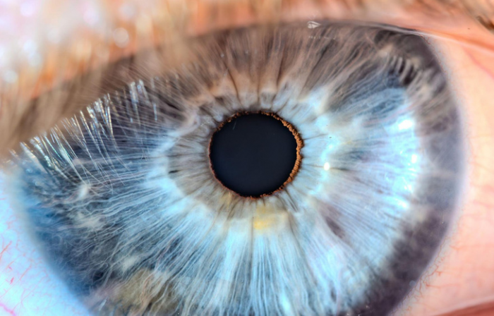 Глаза разных цветов — опасно ли это? Объясняют офтальмологи