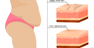 7 простых способов, которые помогут подтянуть провисшую кожу естественным способом