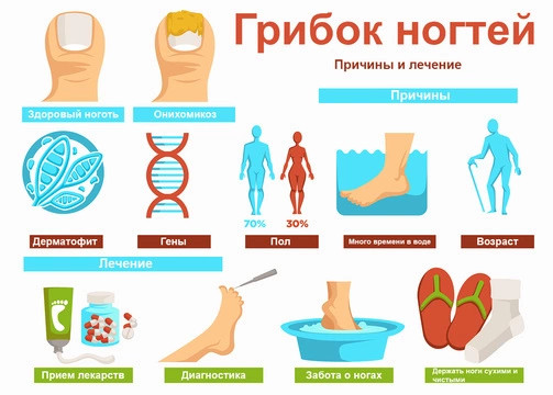 ТОП-15 препаратов от грибка на ногтях