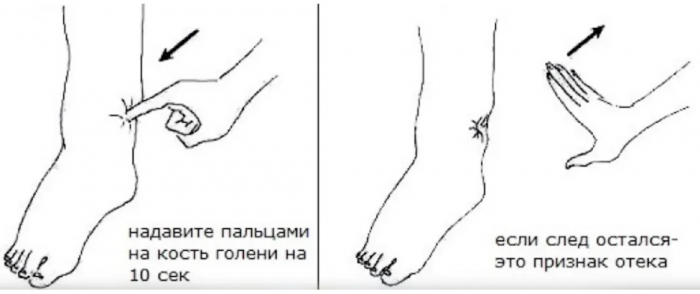 Ходьба не отрывая стоп: активный лимфодренаж, выводим лишнюю воду и отеки