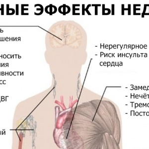 6 болезней, которые мы сами впускаем в свое тело из-за недосыпа