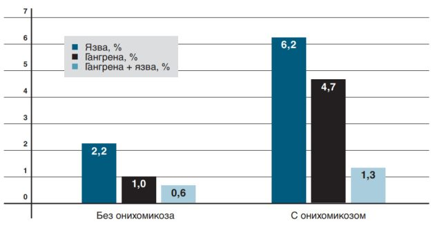 Прижать к ногтю. Симптомы и схемы лечения грибковых инфекций ногтей