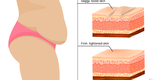 7 простых способов, которые помогут подтянуть провисшую кожу естественным способом