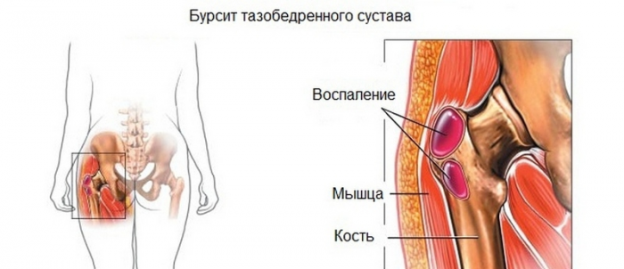 О чем говорит боль в суставах