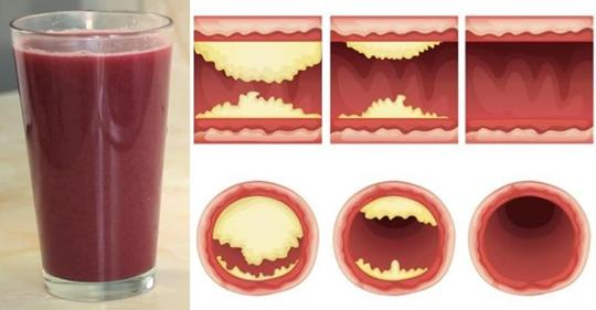 Этот вкусный сок прочистит артерии и предотвратит сердечные заболевания!
