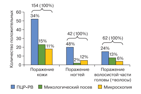 Прижать к ногтю. Симптомы и схемы лечения грибковых инфекций ногтей