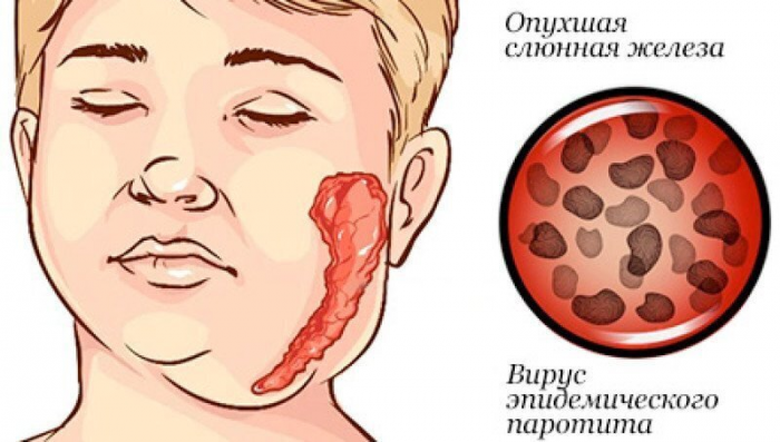 Братство, объединенное шрамами: от каких болезней делают прививки